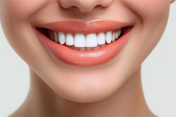 Hollywood Smile